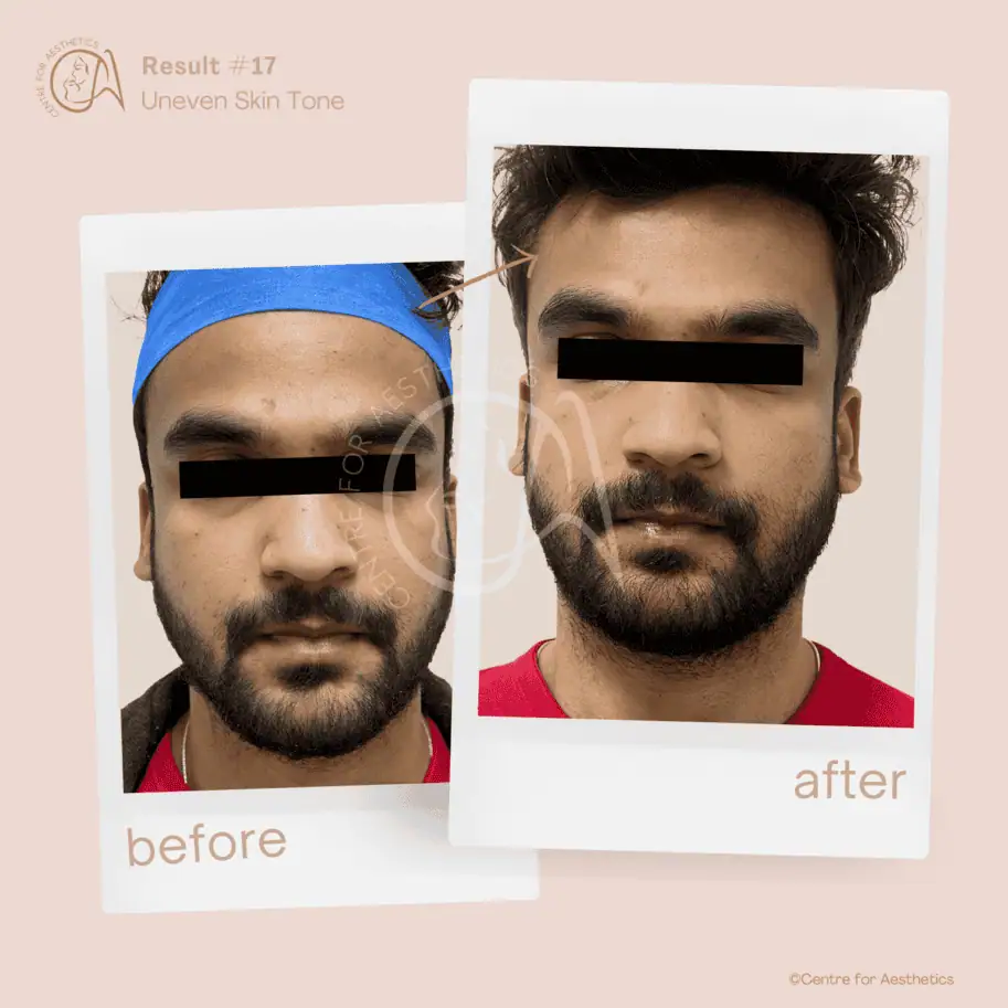 Centre for Aesthetics team in Gurgaon