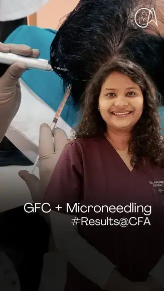 Hair Fall Treatment That Works 💉 | GFC + Microneedling Results in Gurgaon by Dr. Akanksha Agarwal
