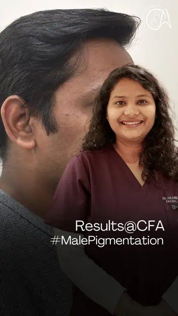 Pigmentation Treatment for Men ✨ | Real Results by Dr. Akanksha Agarwal | Gurgaon Skin Clinic